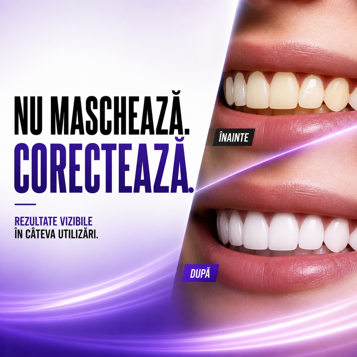 Set Benzi pentru albirea dintilor Neosimply®, Tehnologie PAP+ V34 Mov, 7 tratamente, Spearmint - imagine 8